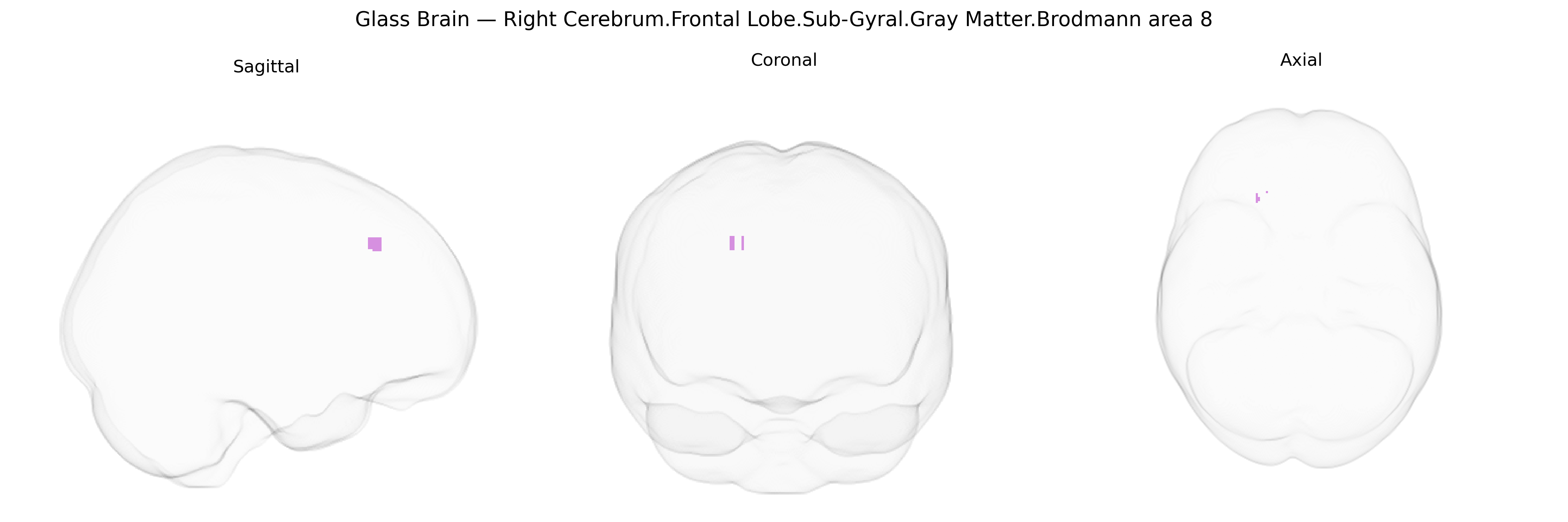 Triplanar Ghost Brain