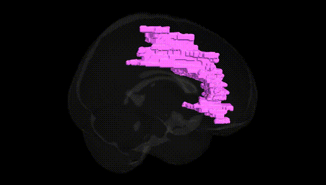 Full Brain Black