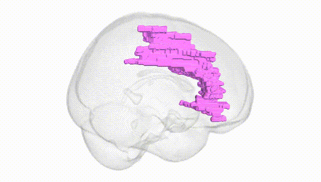 Full Brain White