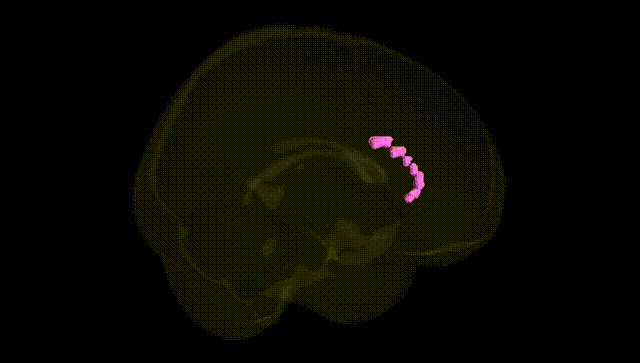 Full Brain Black