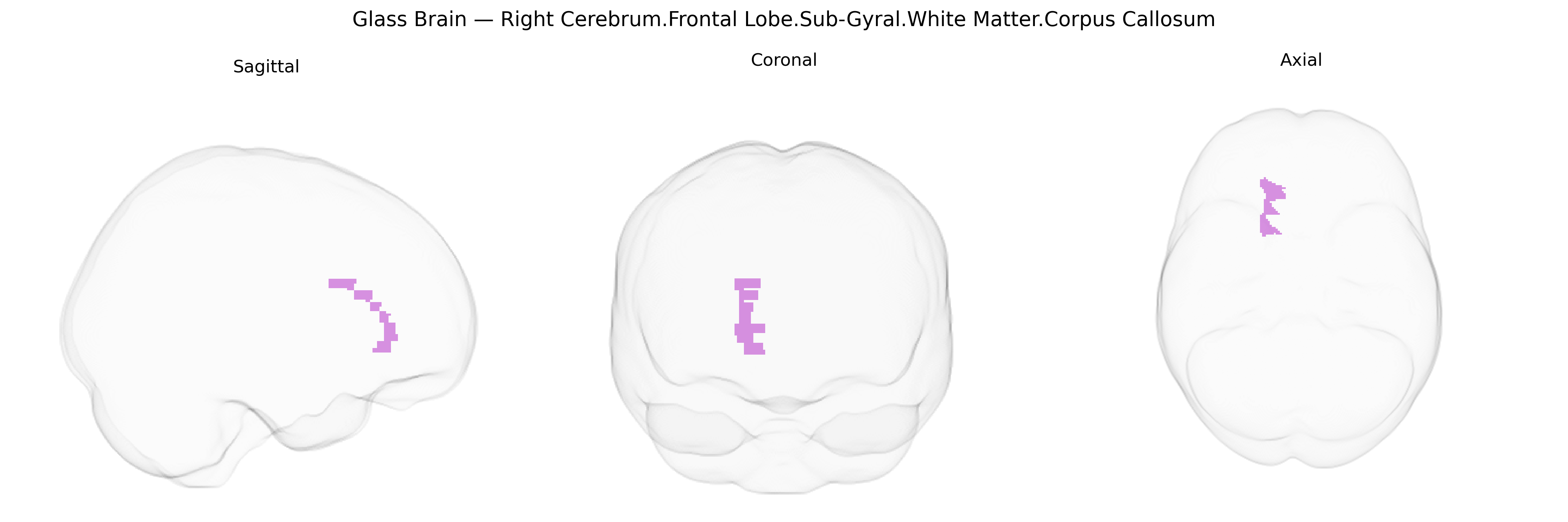 Triplanar Ghost Brain