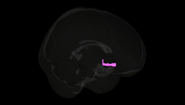 Full Brain Black