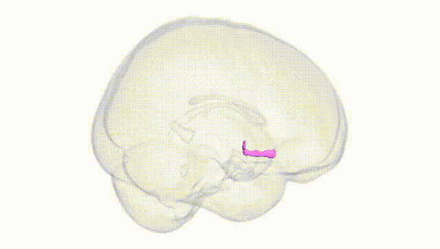 Full Brain White