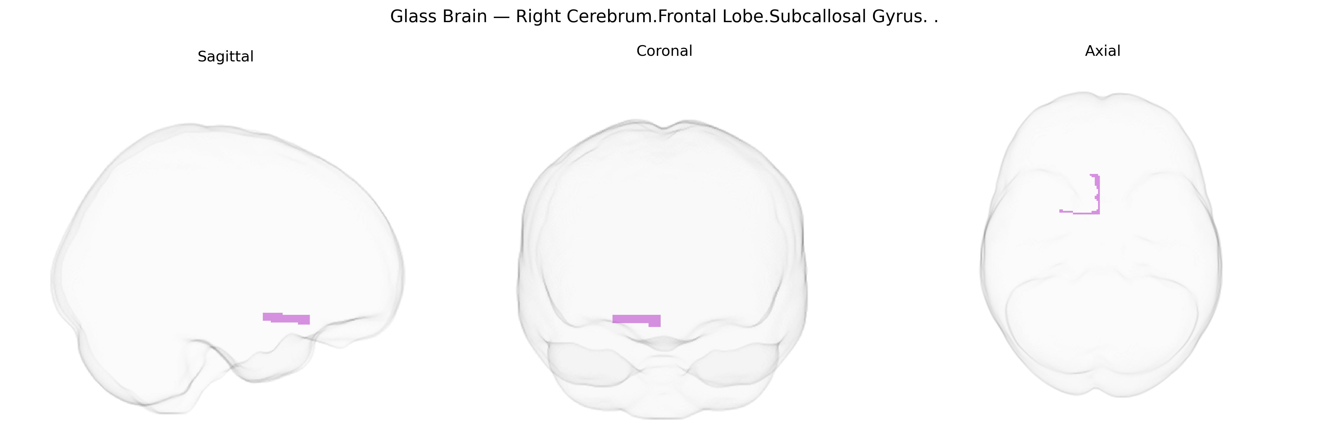 Triplanar Ghost Brain