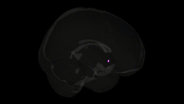 Full Brain Black
