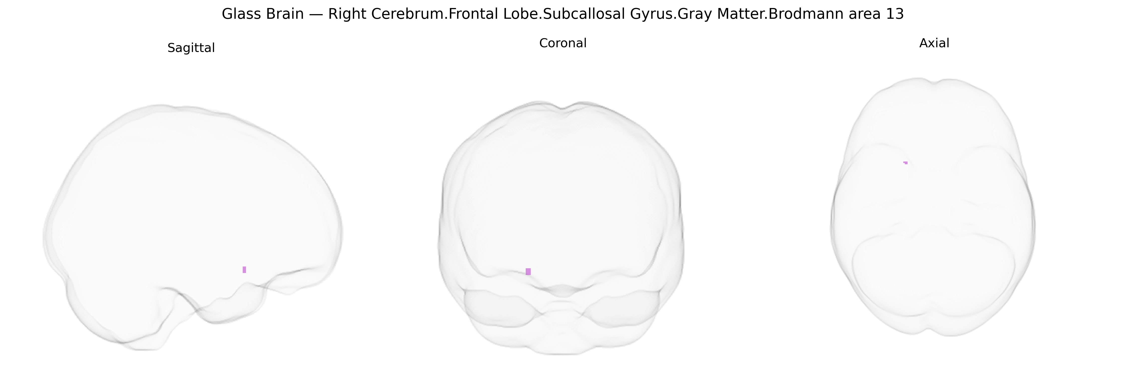 Triplanar Ghost Brain