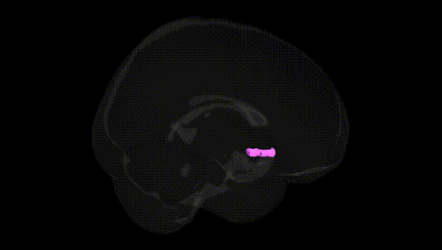 Full Brain Black