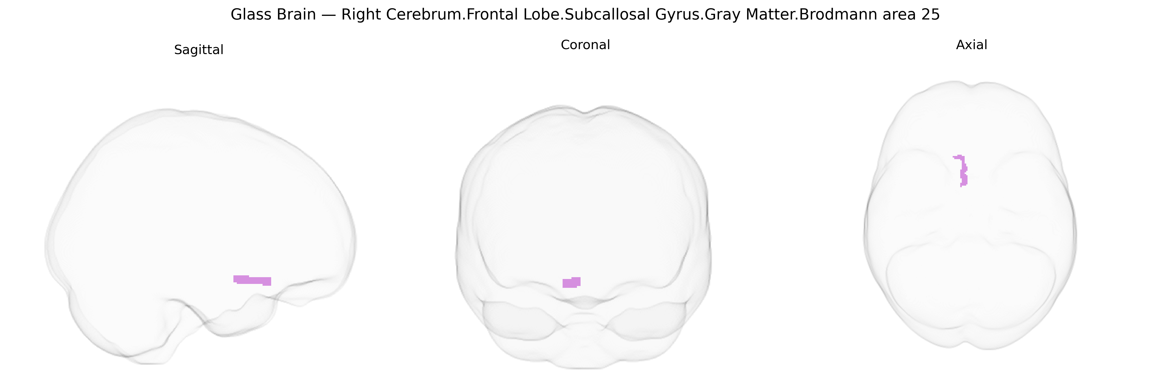 Triplanar Ghost Brain