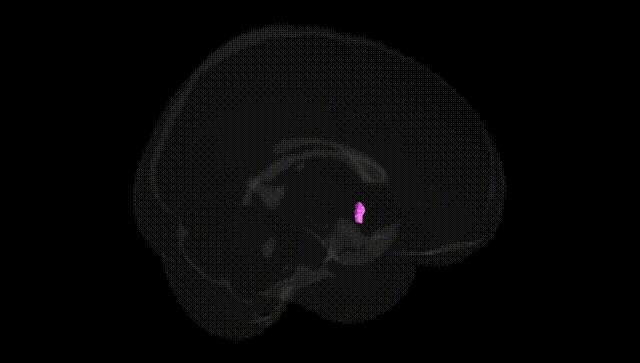 Full Brain Black