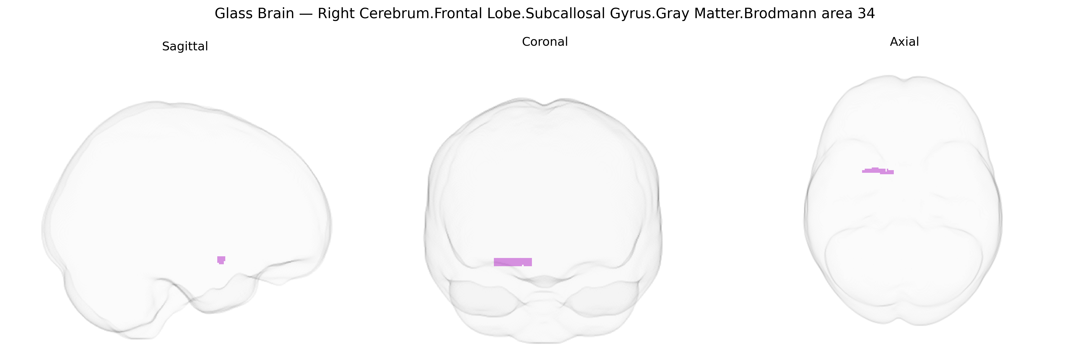 Triplanar Ghost Brain