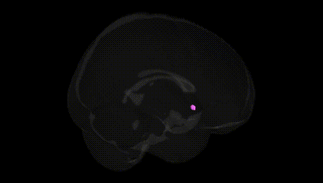 Full Brain Black