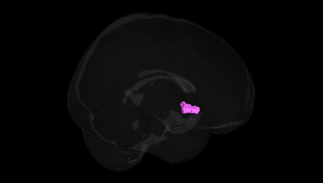Full Brain Black