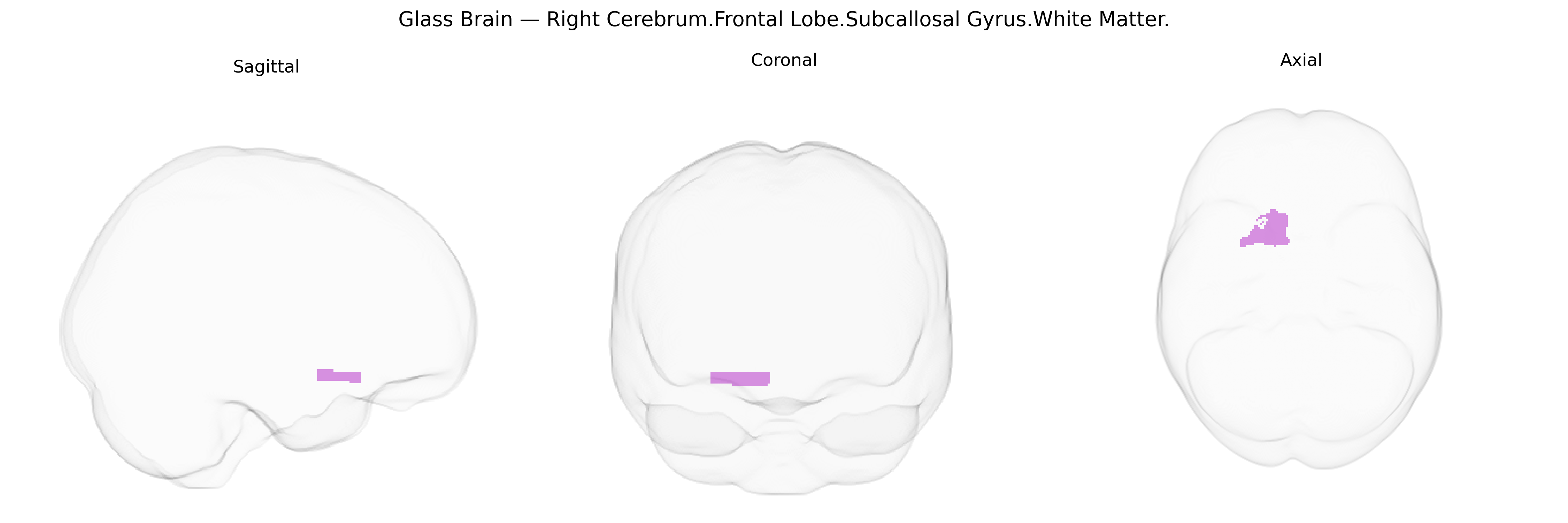 Triplanar Ghost Brain