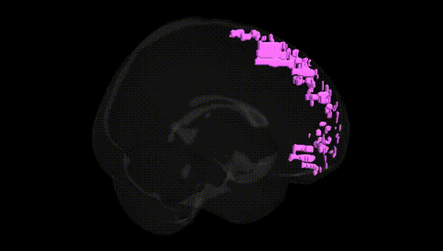 Full Brain Black