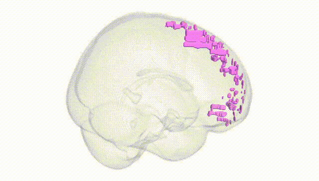 Full Brain White
