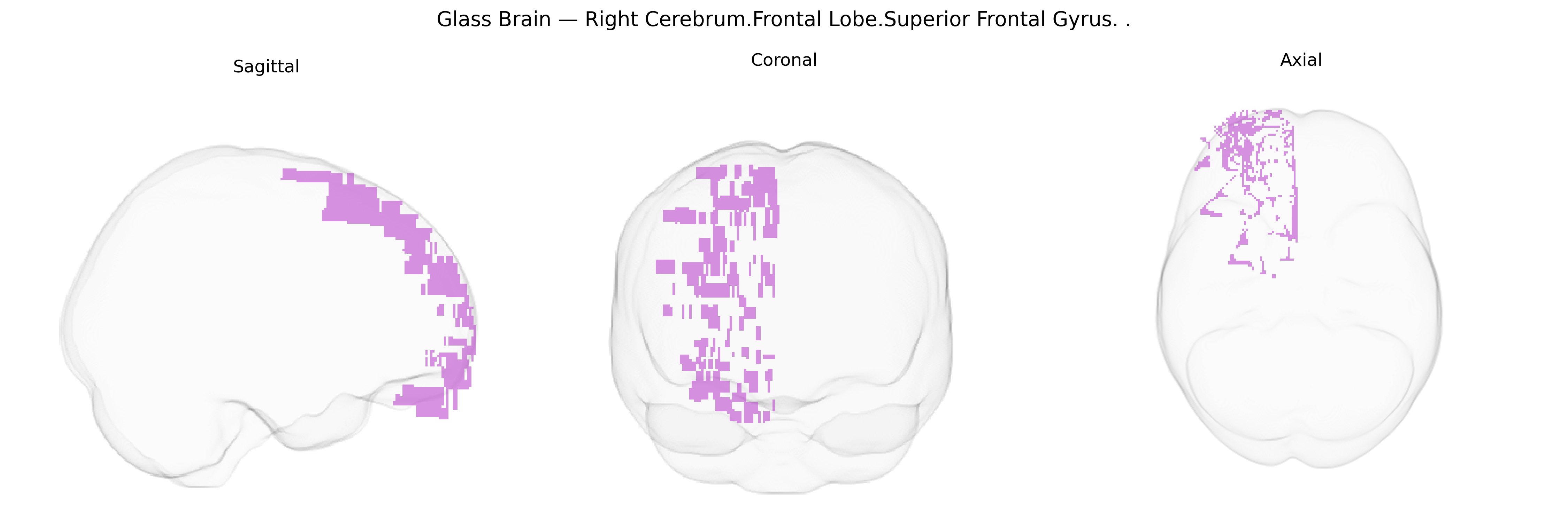 Triplanar Ghost Brain
