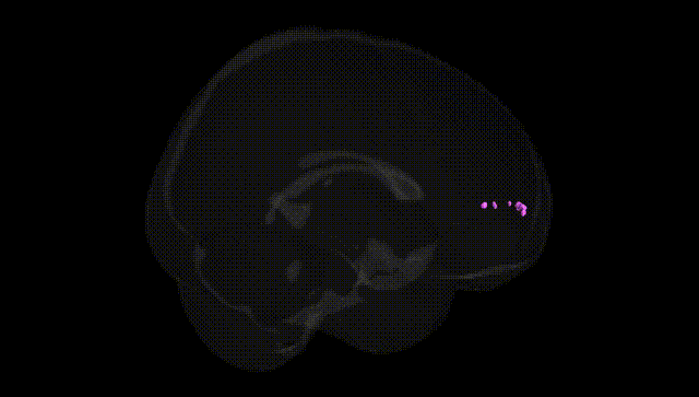 Full Brain Black