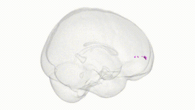 Full Brain White