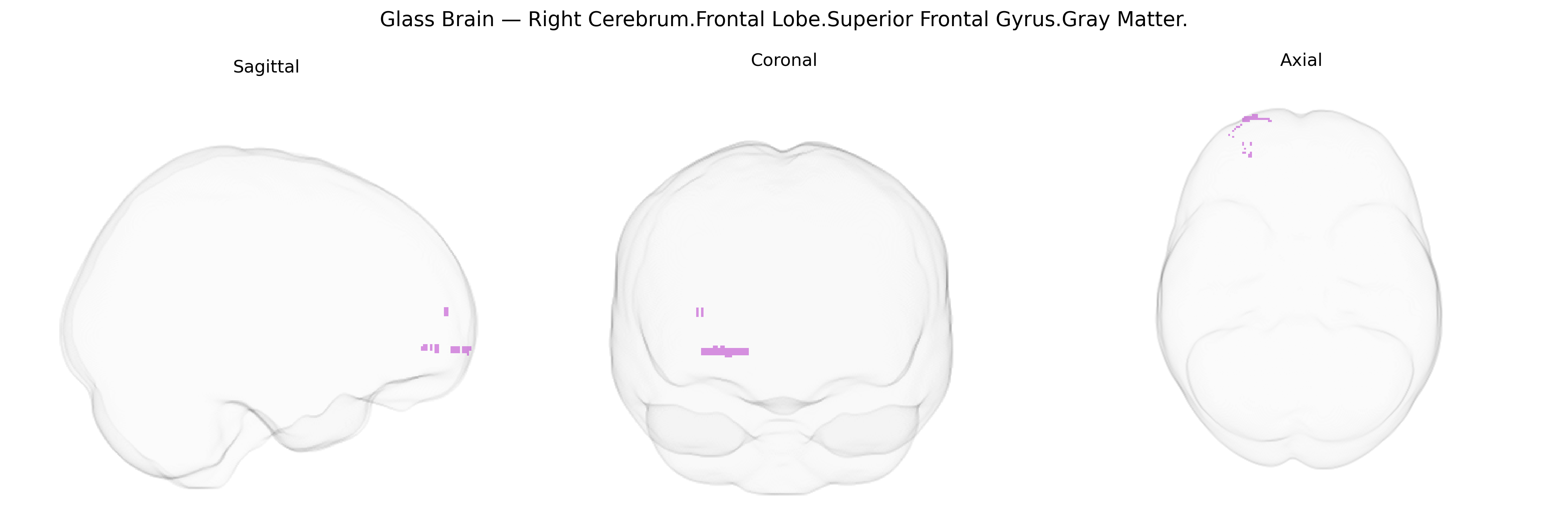 Triplanar Ghost Brain