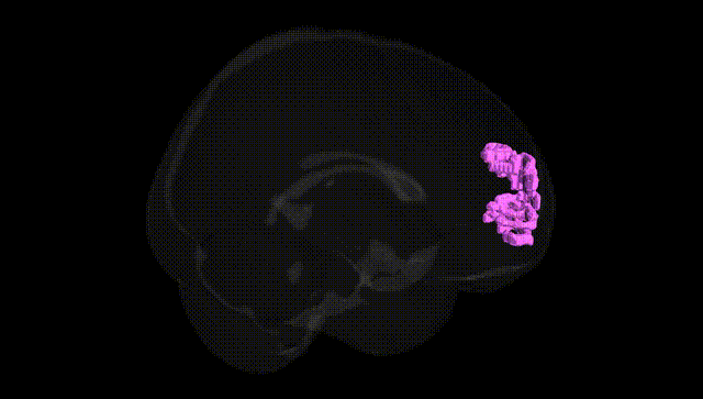 Full Brain Black