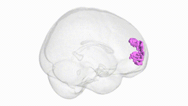 Full Brain White