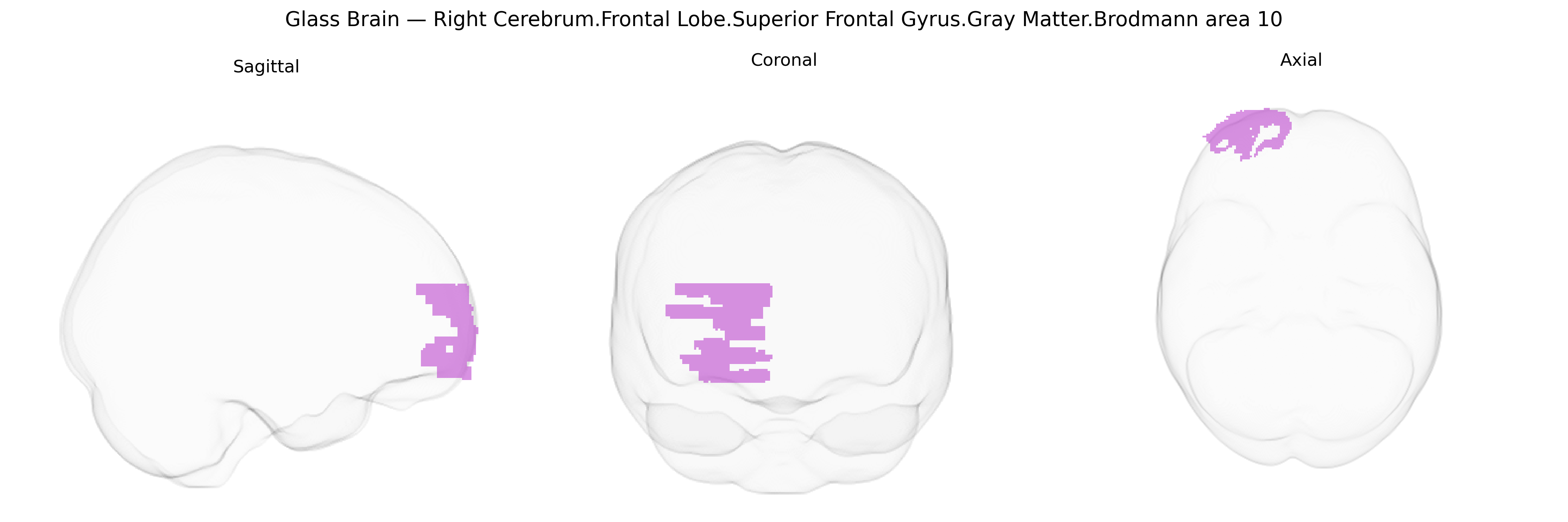 Triplanar Ghost Brain