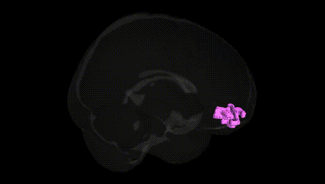 Full Brain Black