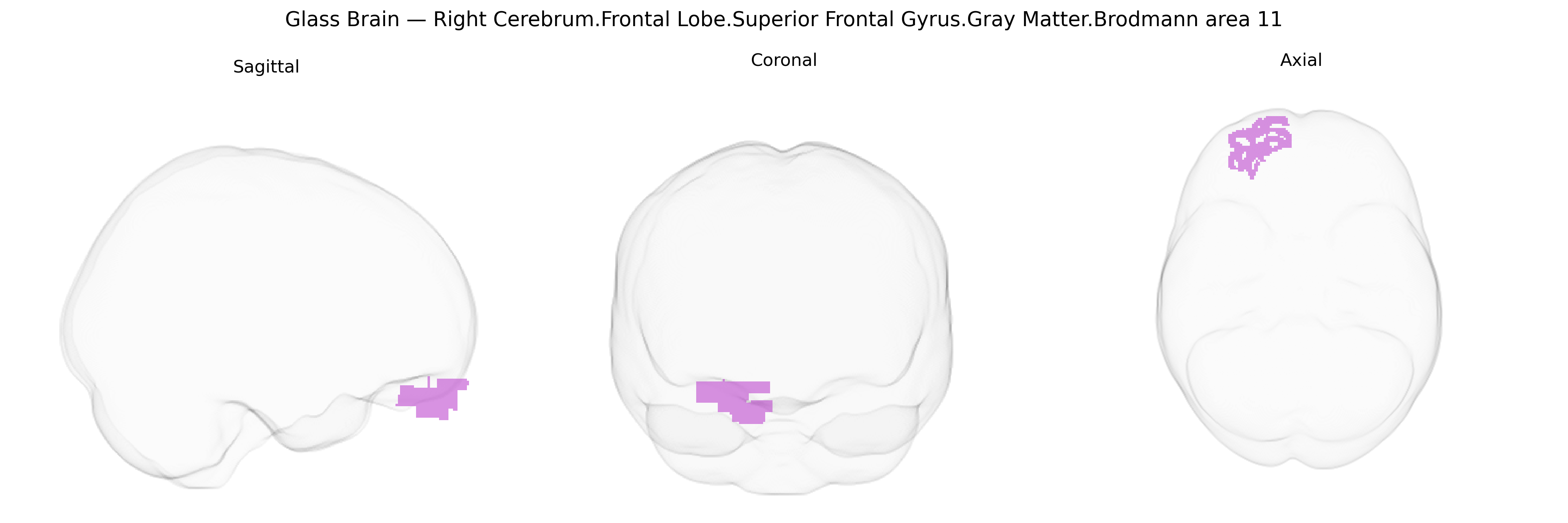Triplanar Ghost Brain