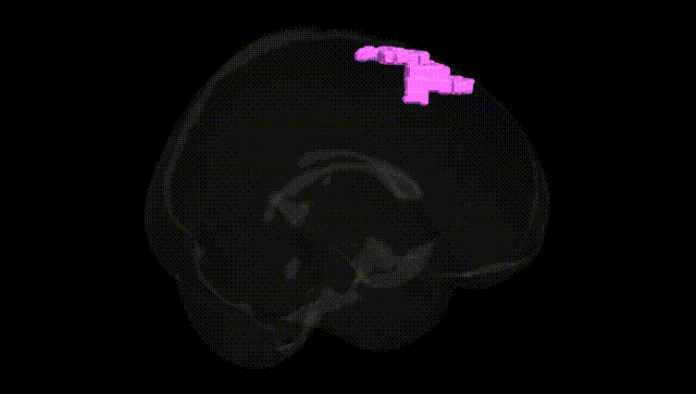 Full Brain Black
