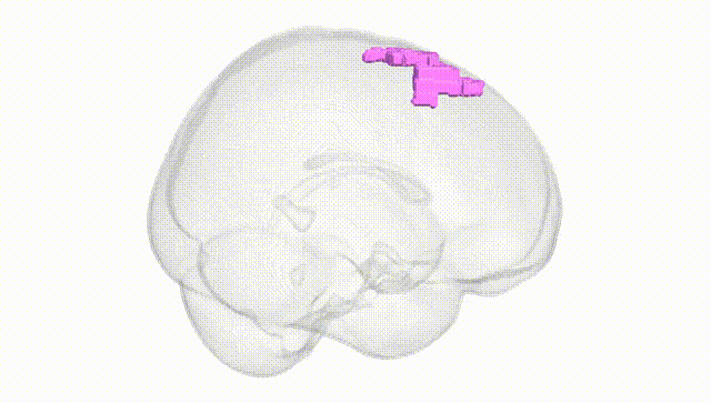 Full Brain White