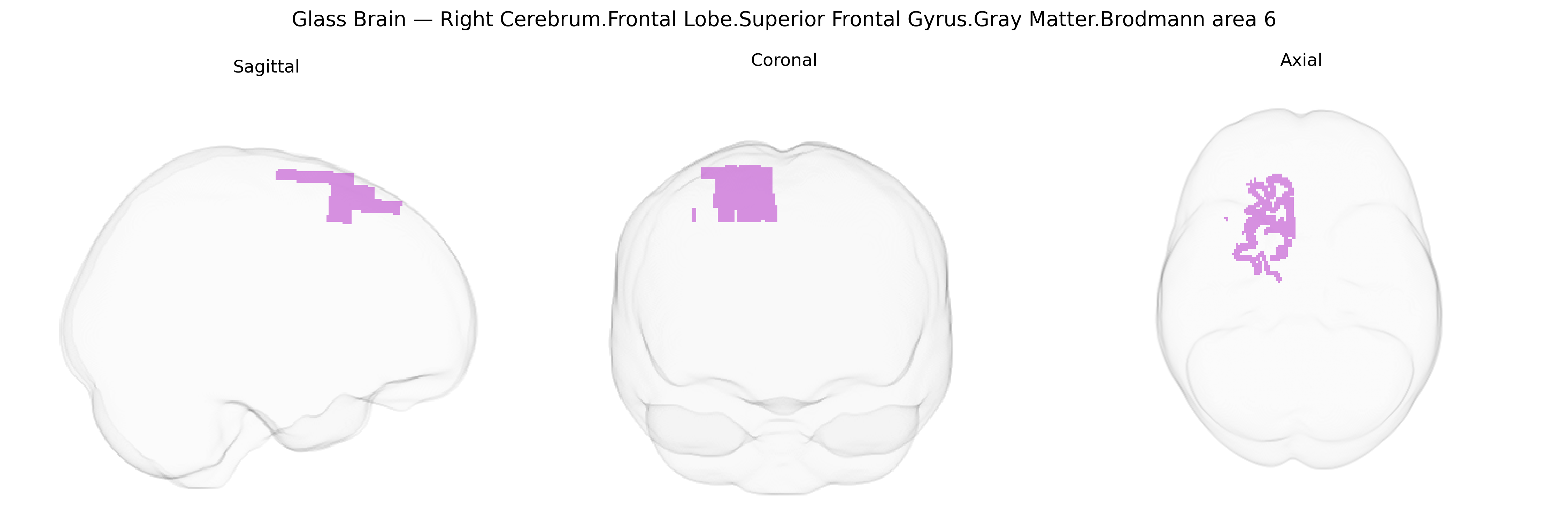 Triplanar Ghost Brain