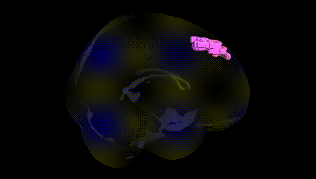 Full Brain Black
