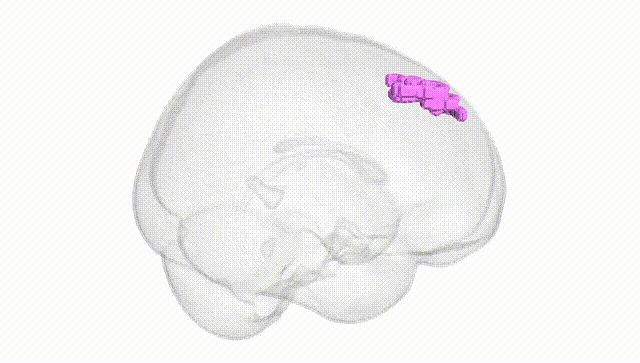 Full Brain White