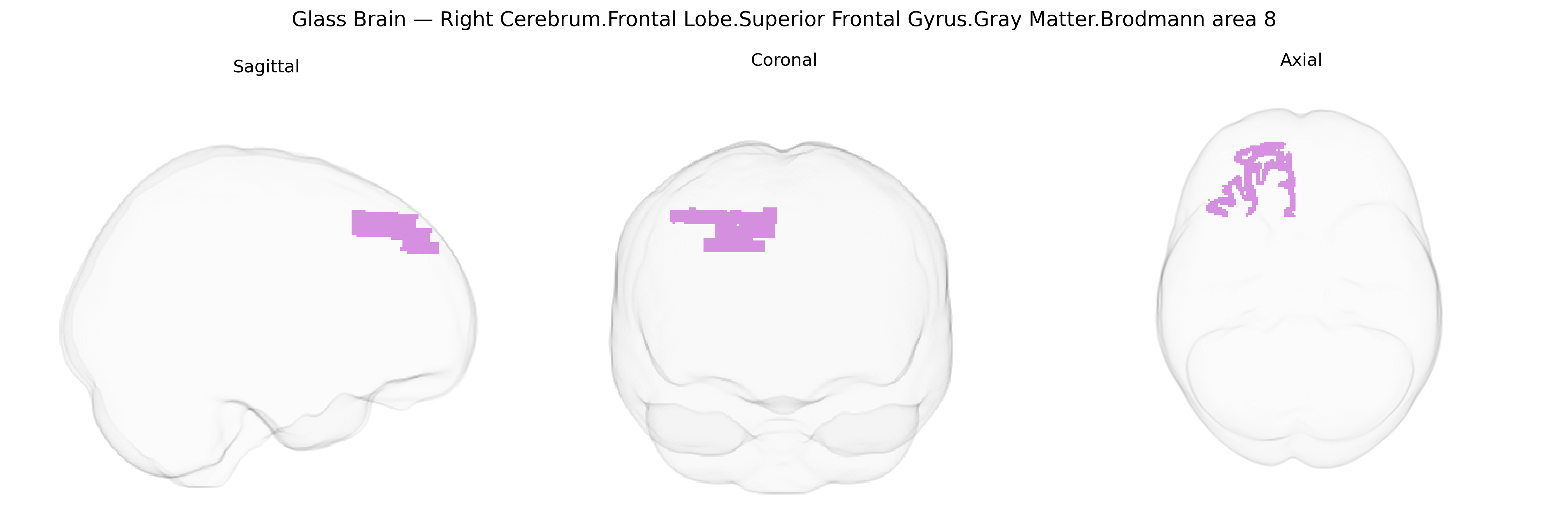 Triplanar Ghost Brain