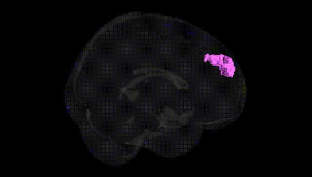 Full Brain Black