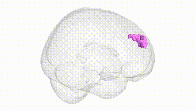 Full Brain White