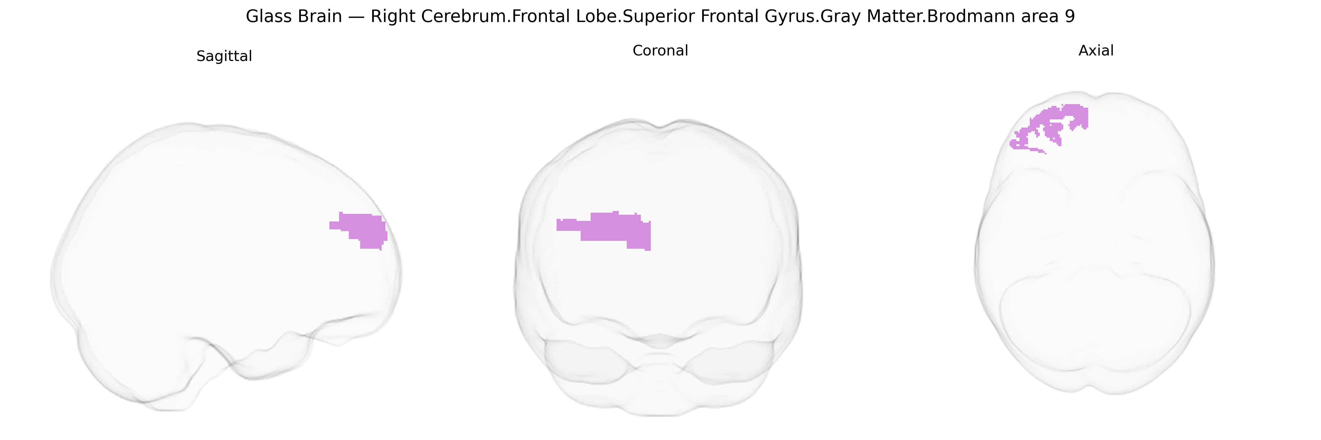Triplanar Ghost Brain
