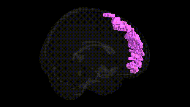 Full Brain Black