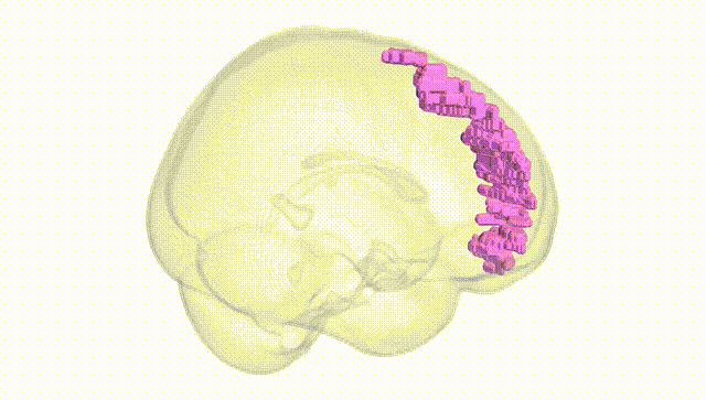 Full Brain White