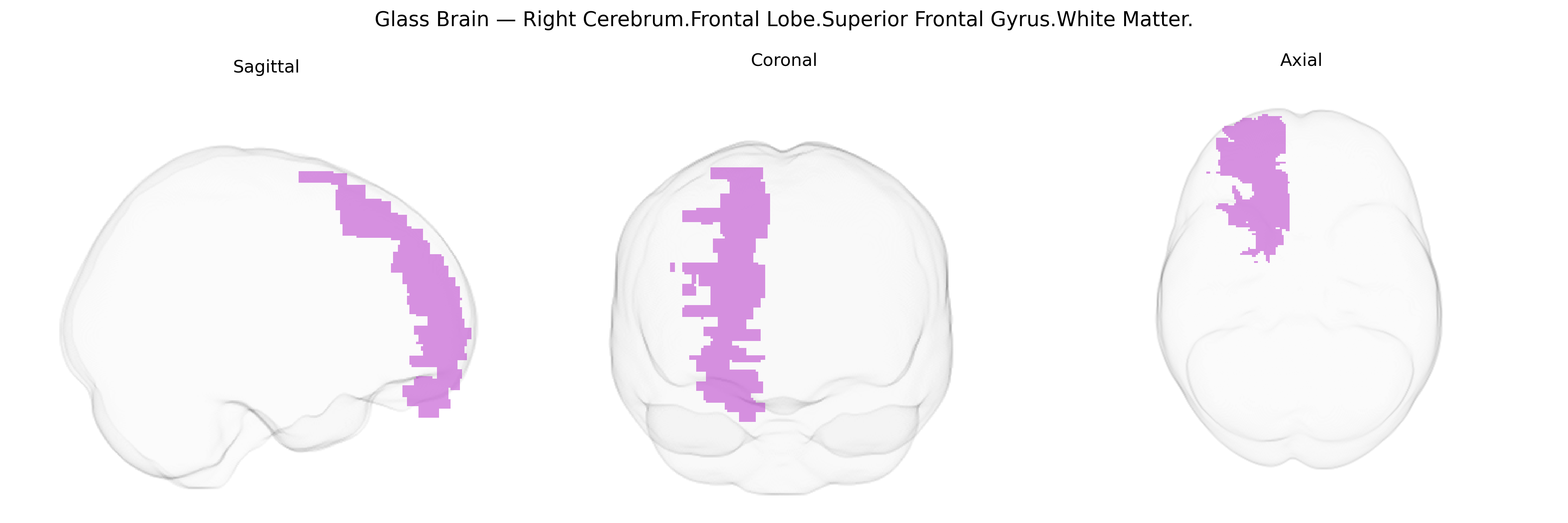 Triplanar Ghost Brain
