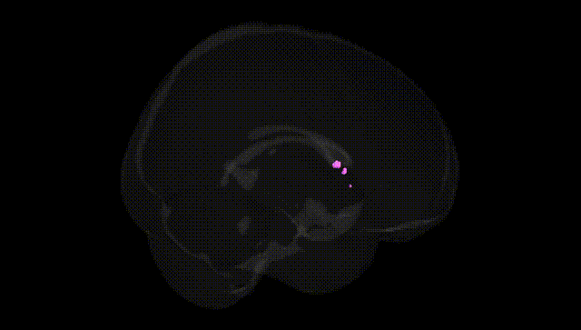 Full Brain Black