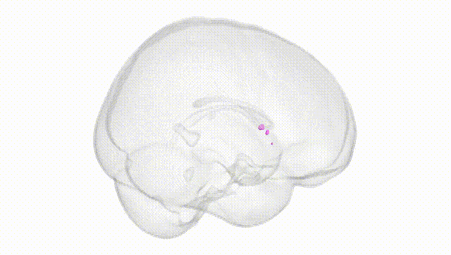 Full Brain White