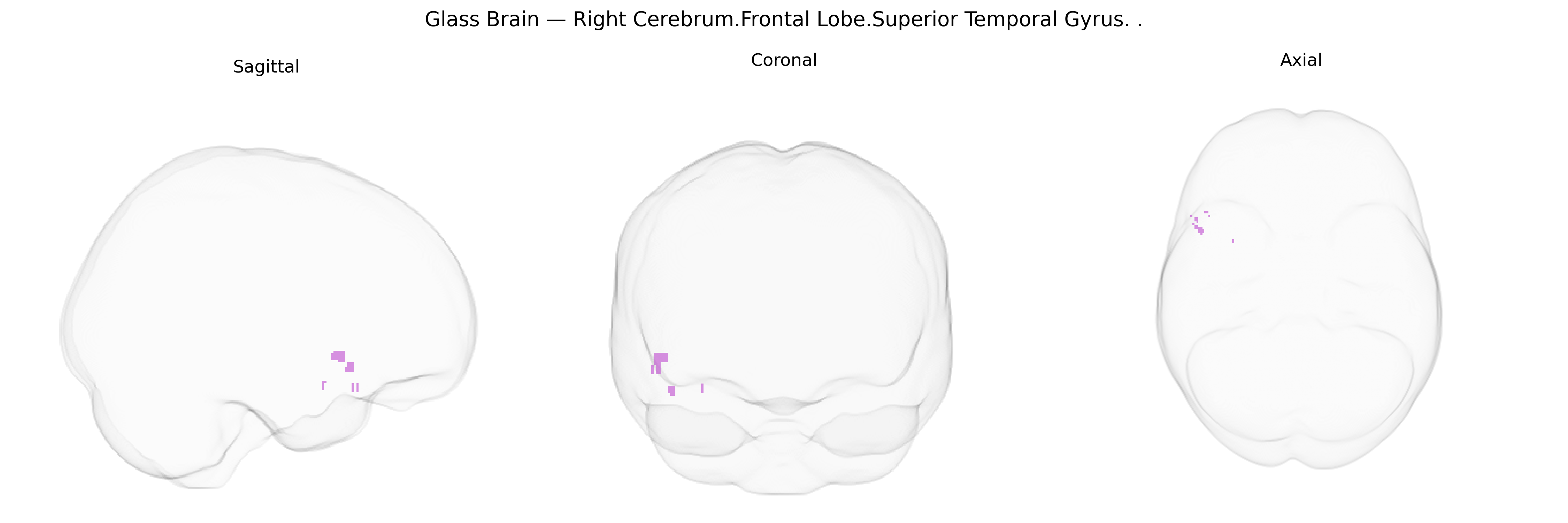 Triplanar Ghost Brain