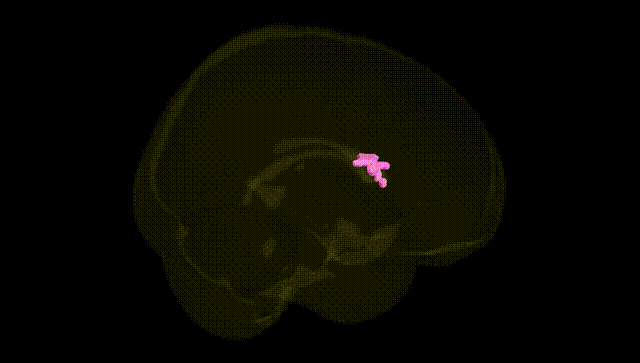 Full Brain Black