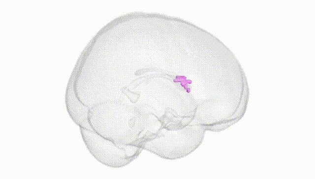Full Brain White