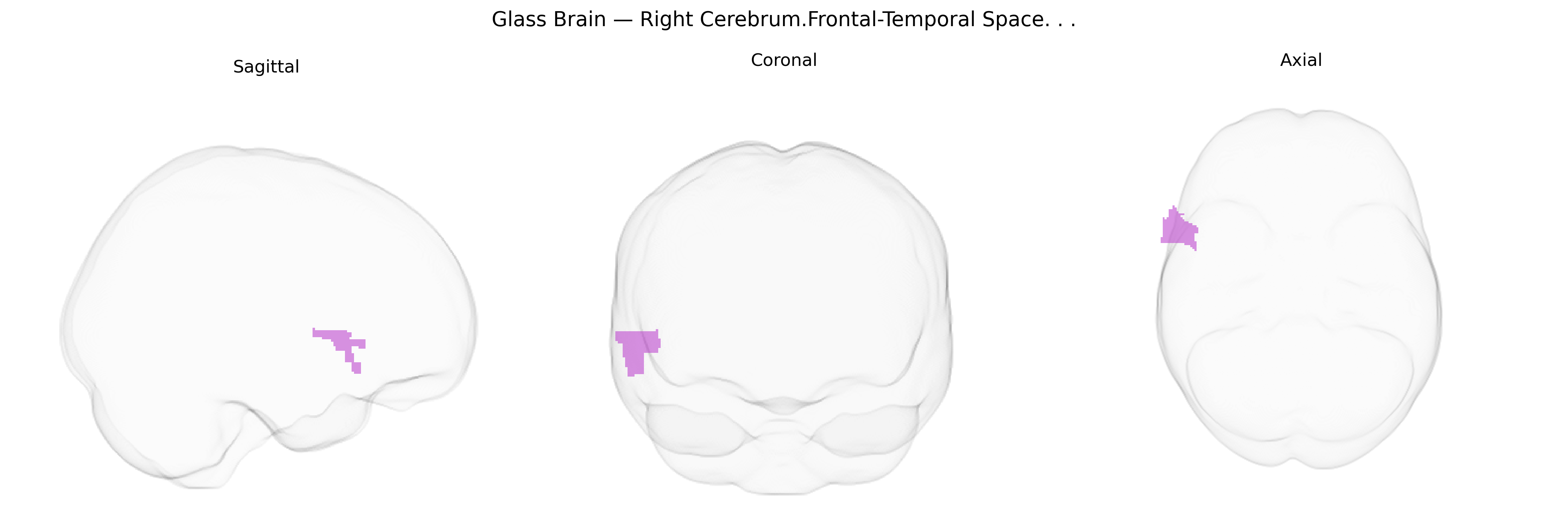 Triplanar Ghost Brain