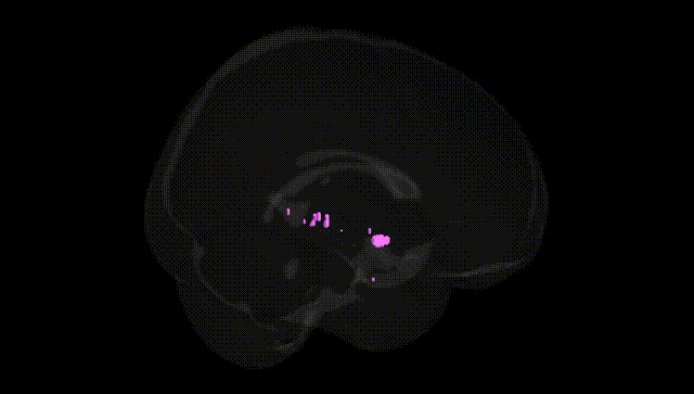 Full Brain Black