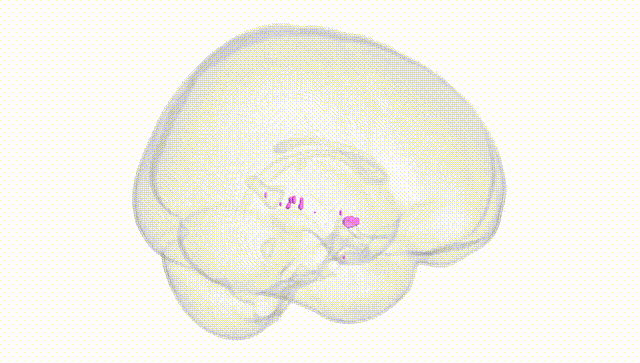 Full Brain White