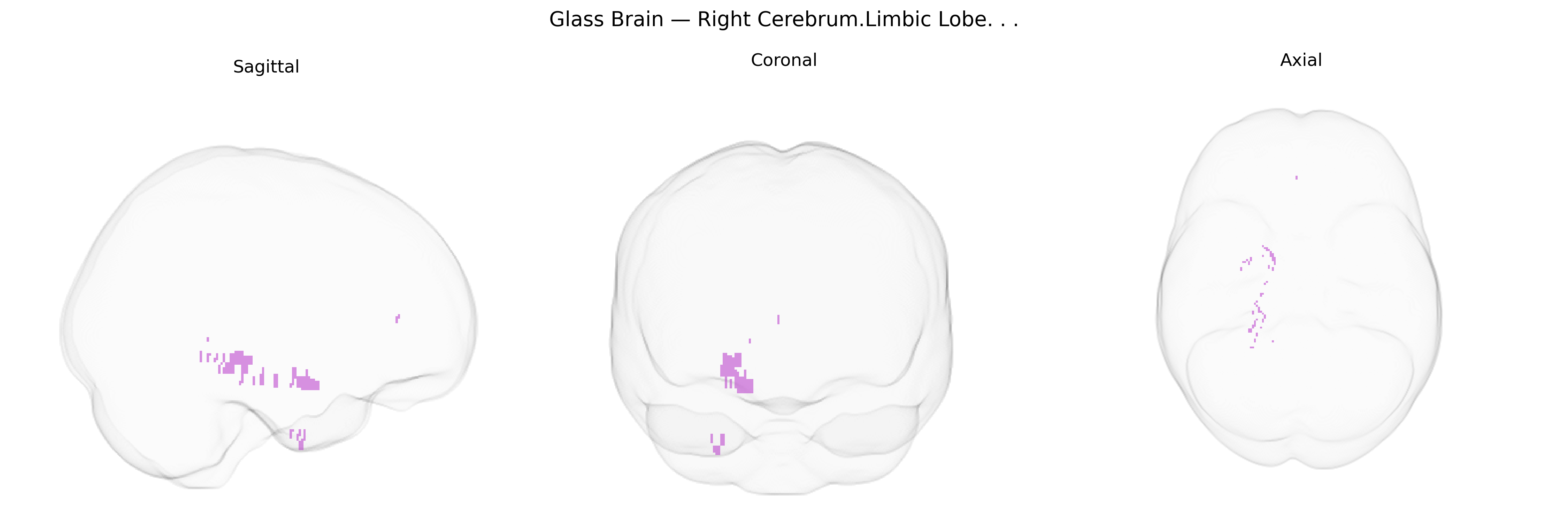 Triplanar Ghost Brain