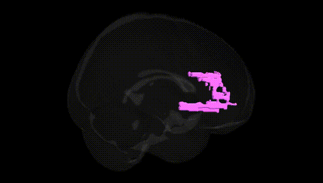Full Brain Black